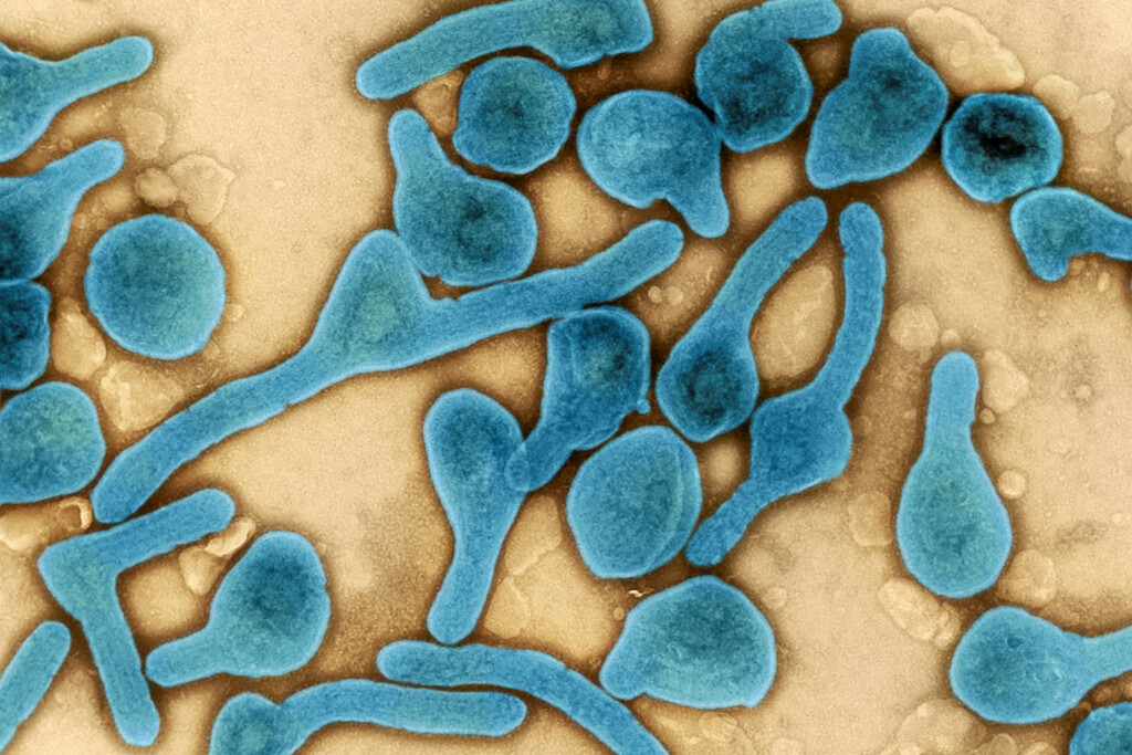 Cdc Warns Doctors To Watch For Marburg Virus Amid Outbreaks In Two African Nations