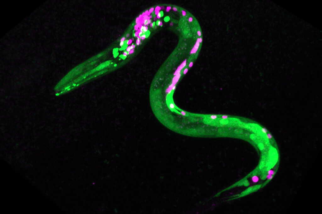 Worms Get The Munchies, Too, Study Reveals