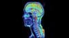 Many People Are Tired Of Grappling With Long Covid. Here Are Some Evidence Based Ways To Counter It