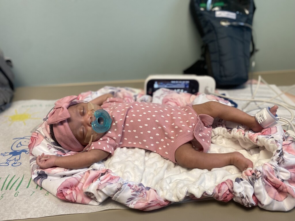 Doctors Performed Brain Surgery On A Baby Before She Was Born And Now She’s Thriving