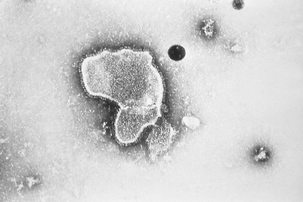 Cdc Vaccine Advisers’ Vote Sets Stage For First Rsv Shot For Older Adults This Fall