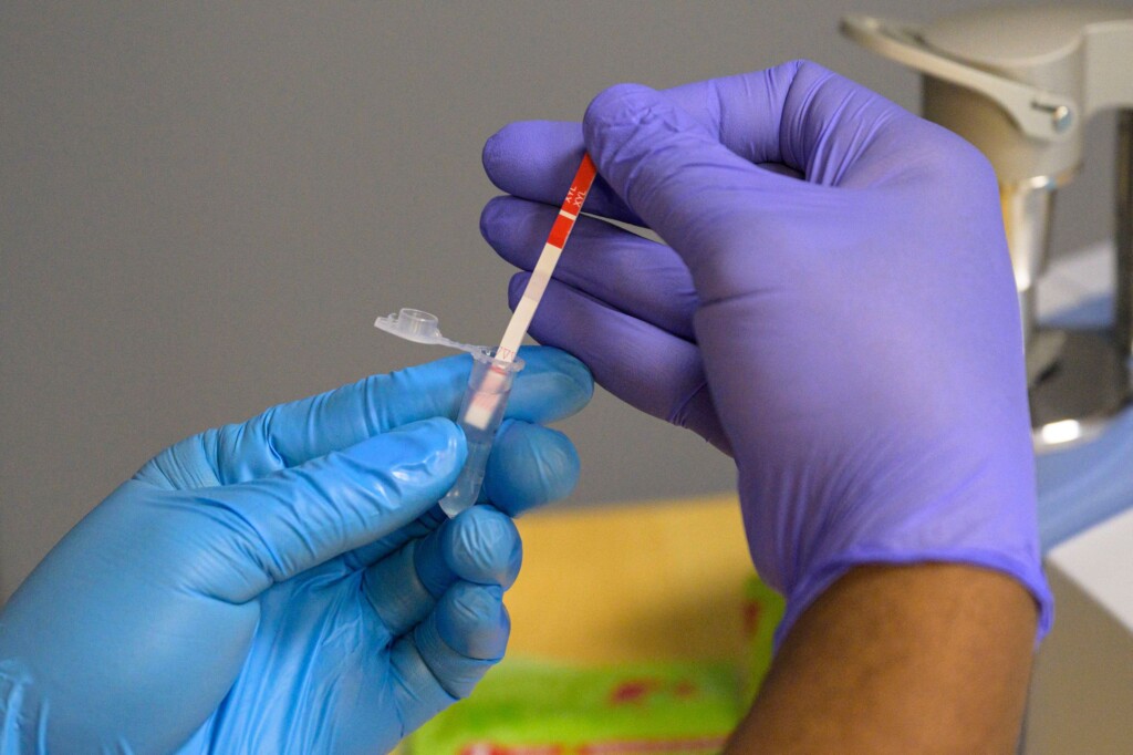 Xylazine Present In More Than 1 In 10 Fentanyl Overdose Deaths In The Us