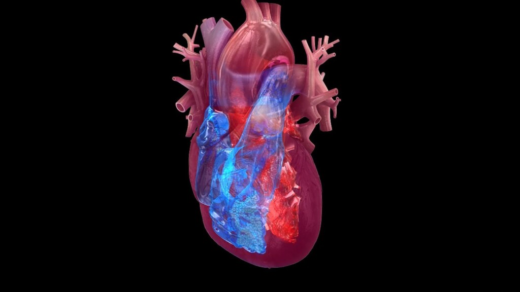 Black People In Redlined Neighborhoods Face Higher Risks For Heart Failure
