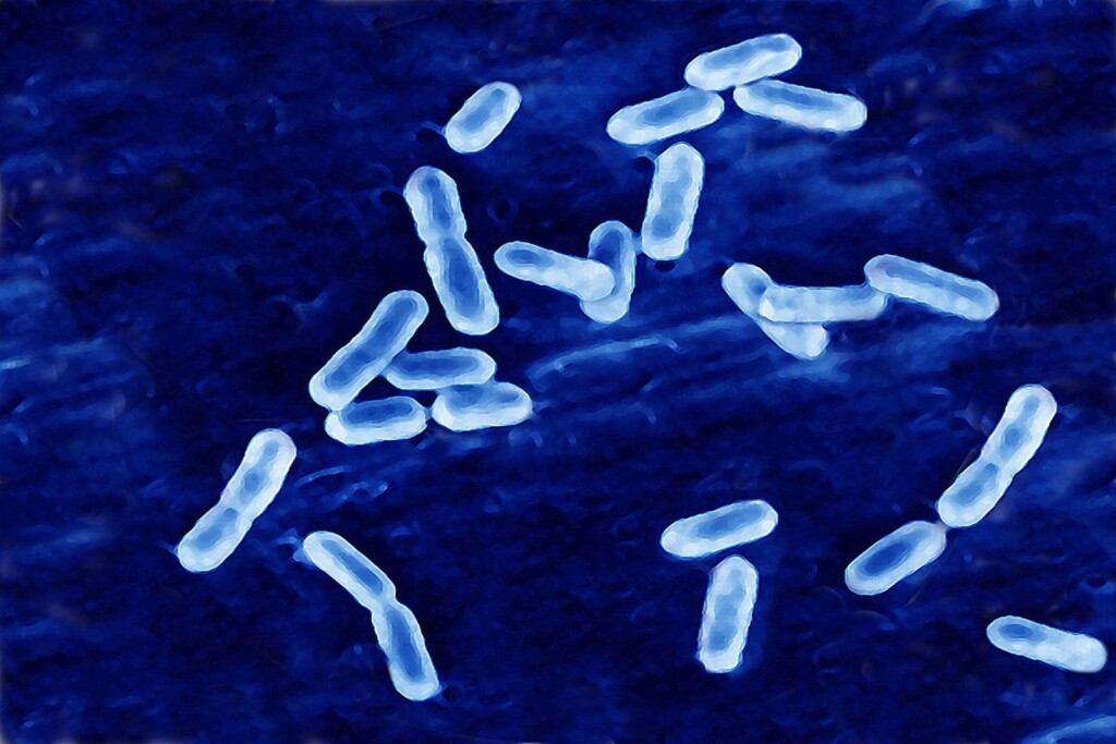 Five Hospitalized, Three Dead In Washington Listeria Outbreak