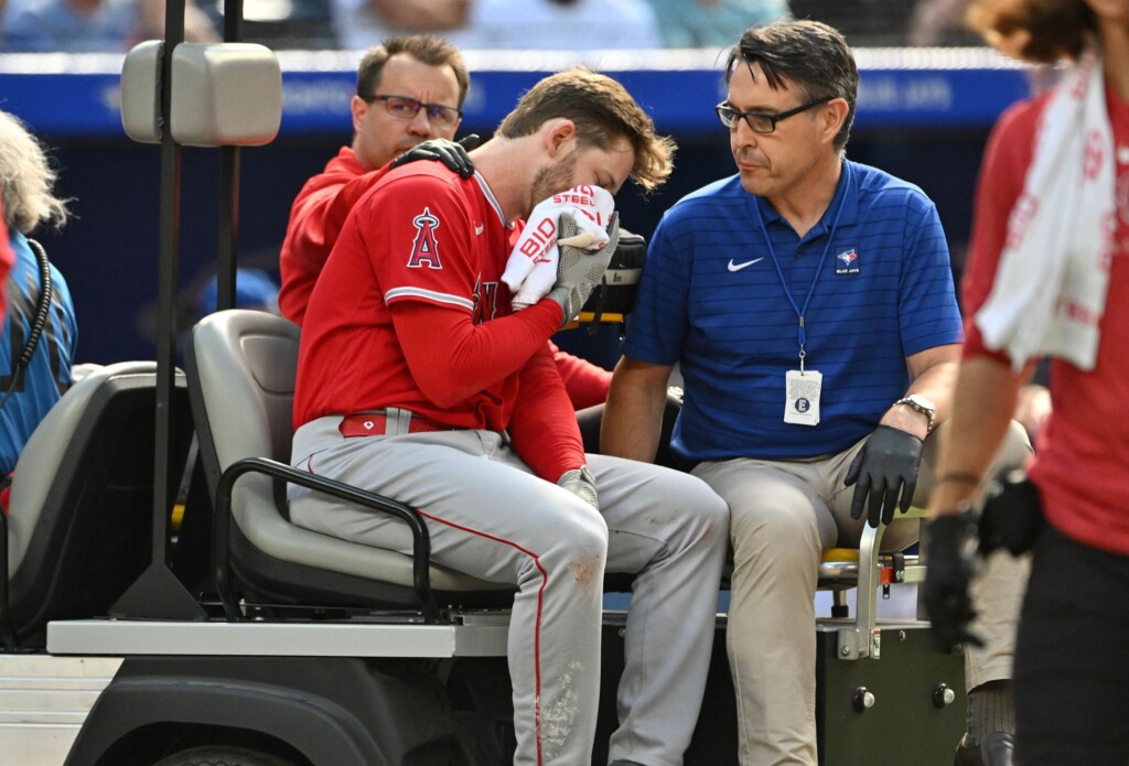 Taylor Ward Suffers Facial Fractures After Being Hit By 91mph Pitch
