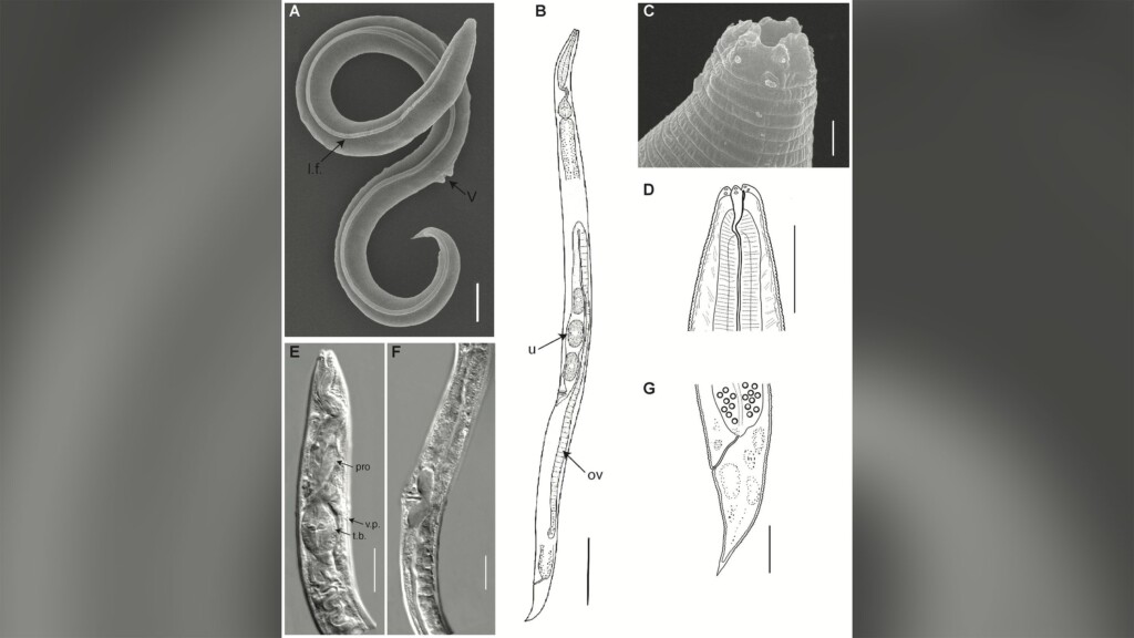 A Worm Has Been Revived After 46,000 Years In The Siberian Permafrost