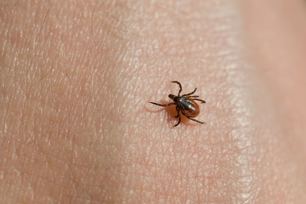 This Could Be The Peak Of Tick Season – And Tick Borne Diseases Are On The Rise