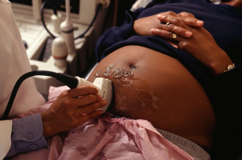 1 In 5 Women – And Even More Black, Hispanic Mothers – Report Mistreatment During Maternity Care, According To Cdc Report