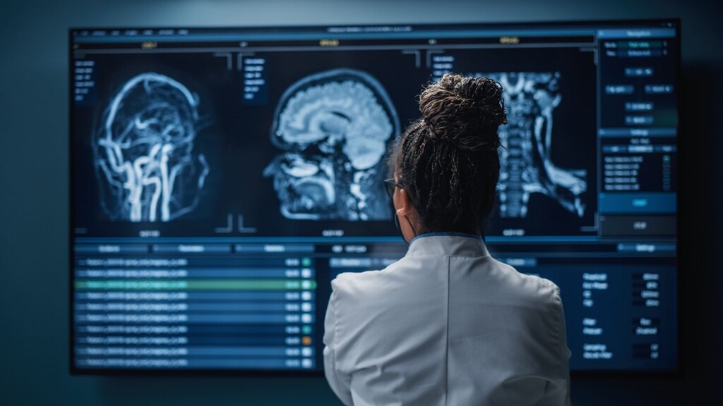 Largest Study Of Brains Of Athletes Younger Than 30 Finds Early Signs Of Cte Even In Amateur Players