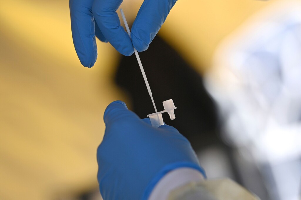 Early Lab Tests Suggest New Covid 19 Variant Ba.2.86 May Be Less Contagious And Less Immune Evasive Than Feared