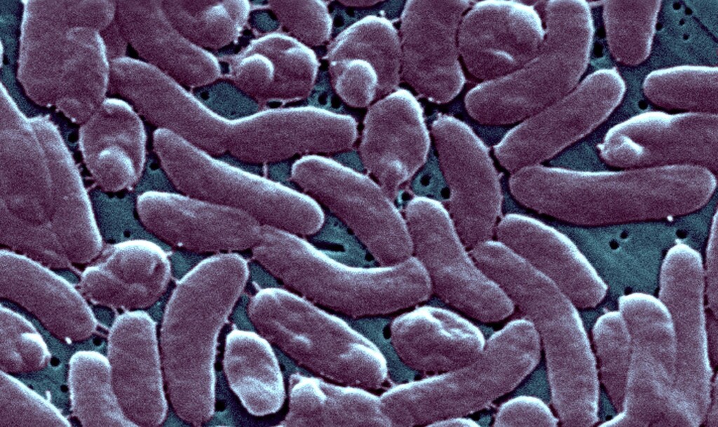Cdc Warns Doctors To Be On Alert For Cases Of Flesh Eating Bacteria Vibrio Vulnificus