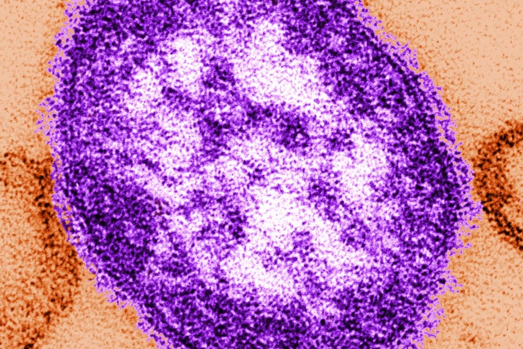 Adult Woman Dies Of Measles Complications In Growing Pennsylvania Outbreak