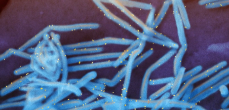 Respiratory Illnesses