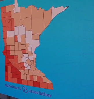 Alzheimers