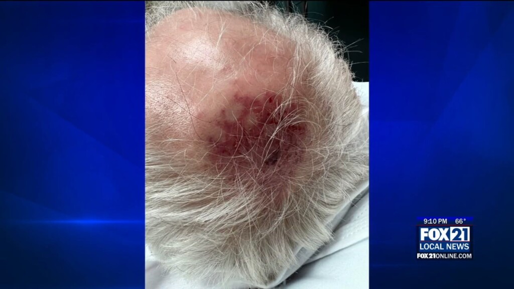 Hermantown Assault Update