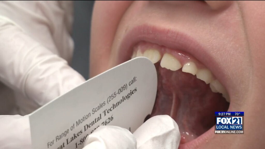 Orofacial Myofunctional Therapy