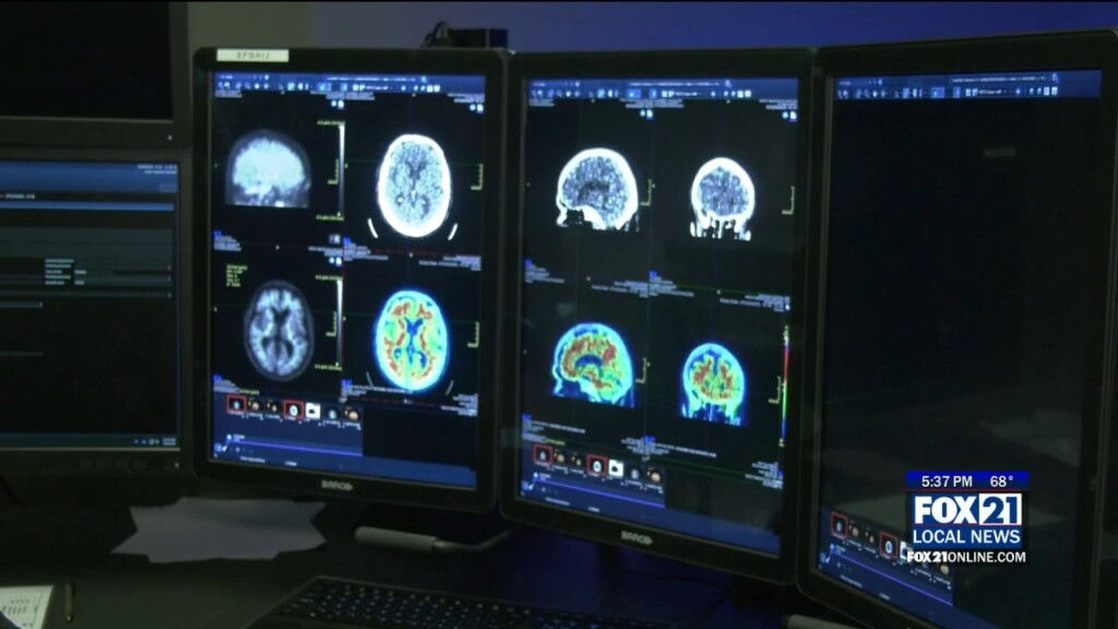 Essentia Health Rolls Out Promising Alzheimers Detection Method