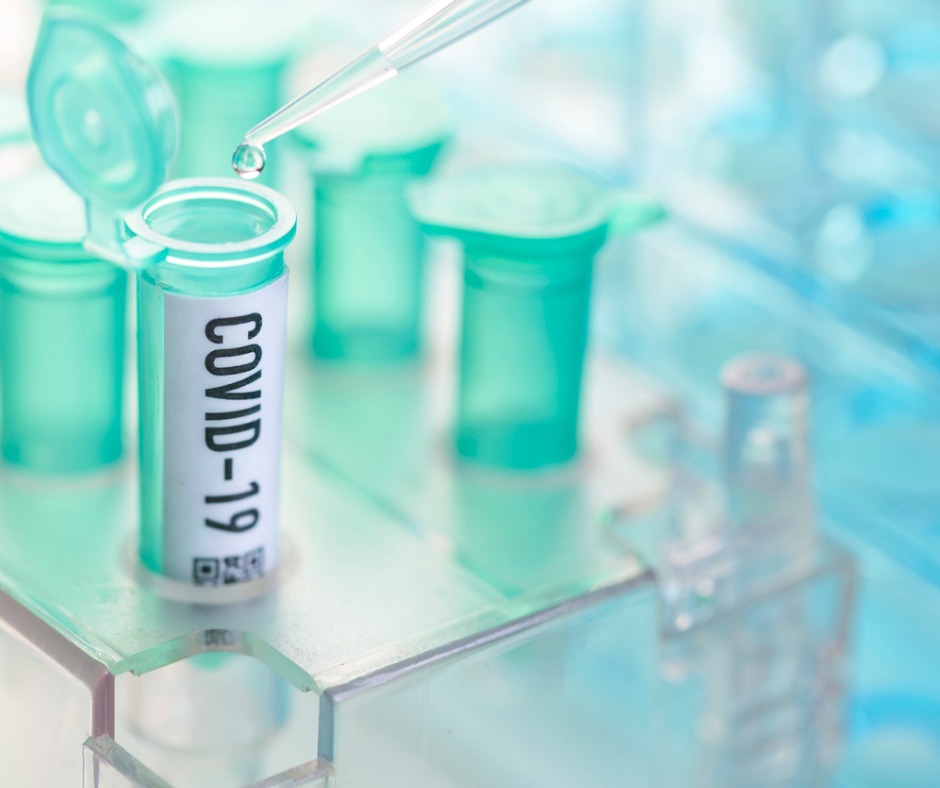 Corona Virus Vial With Pipette In Laboratory Picture Id1206578214
