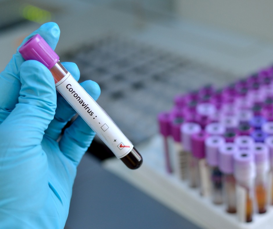 Coronavirus Positive Picture Id477276082