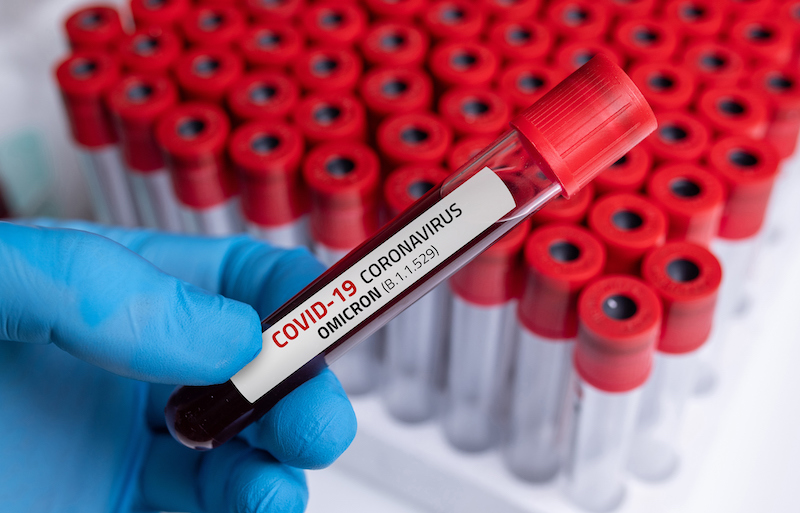 Doctor With Blood Sample Of Covid 19 Omicron B.1.1.529 Variant And General Data Of Covid 19 Coronavirus Mutations.