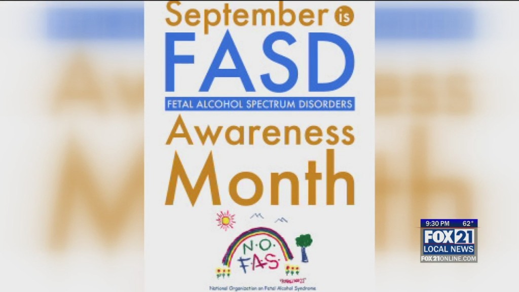 Fas