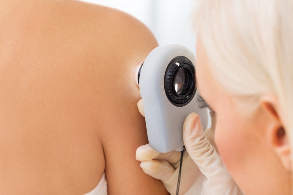 Dermatologist Checking For Skin Cancer