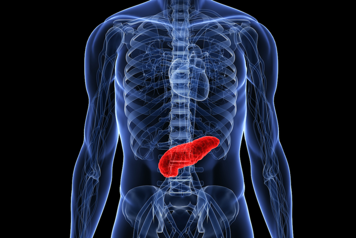 Pancreatic Cysts Link Studio Medical Illustration - vrogue.co