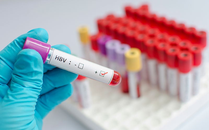 Hepititis B Virus