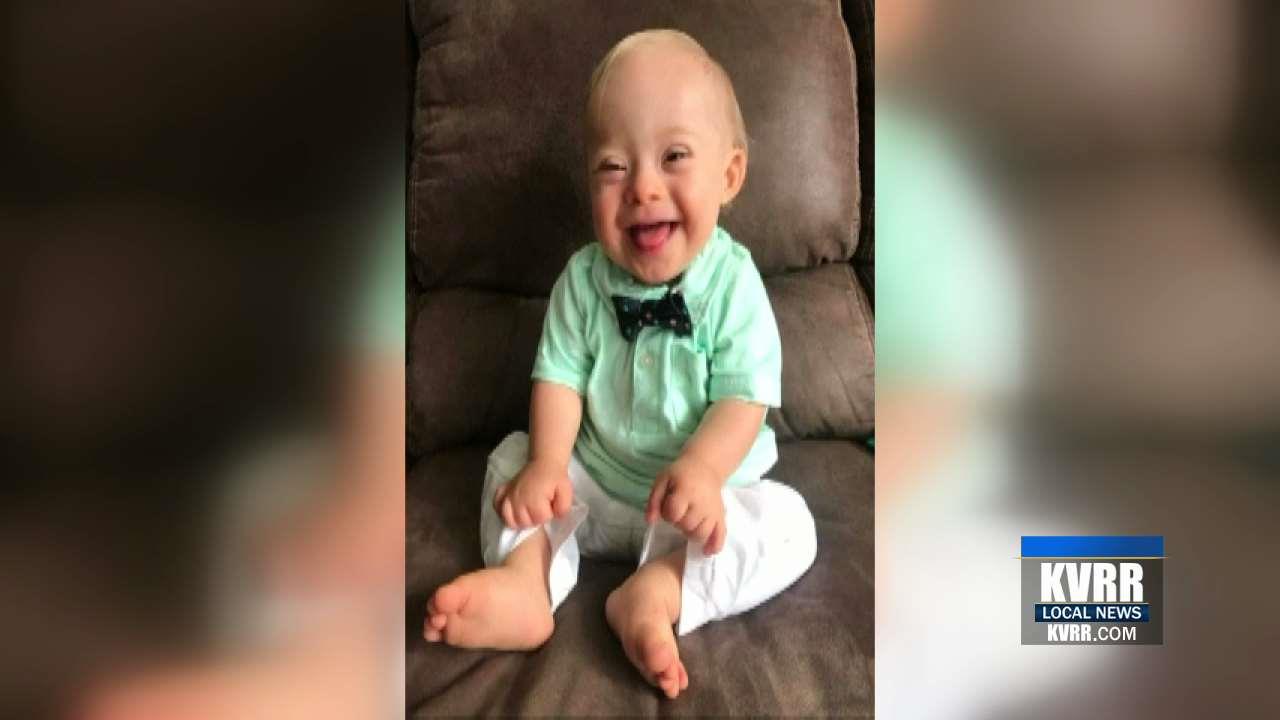 Gerber Baby with Down Syndrome is Inspiring Families in the Valley ...