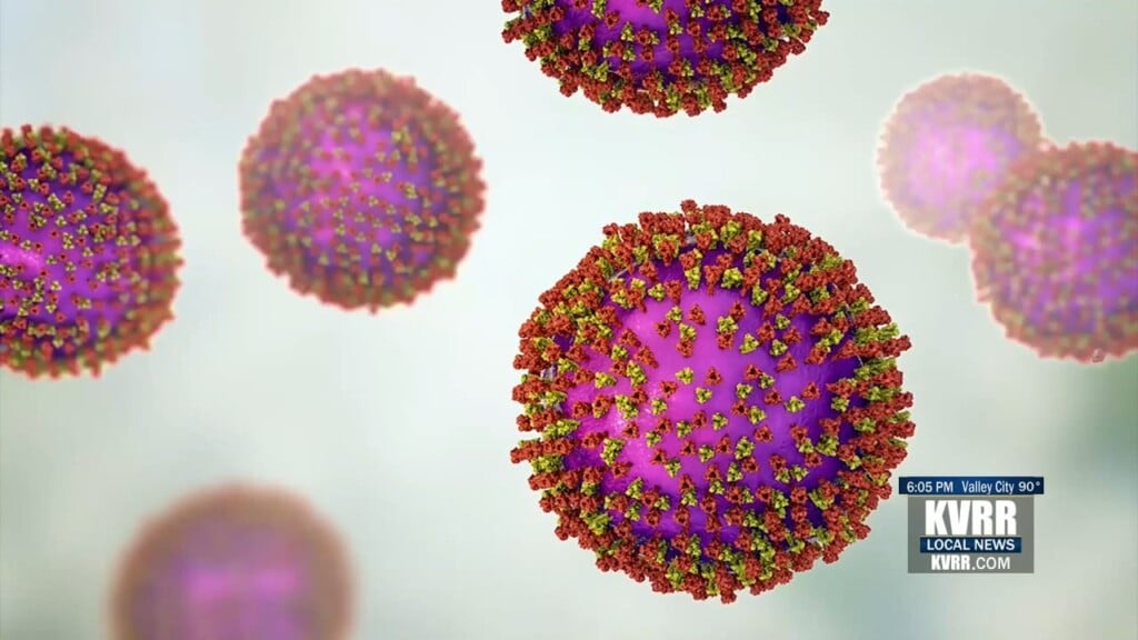 Measles