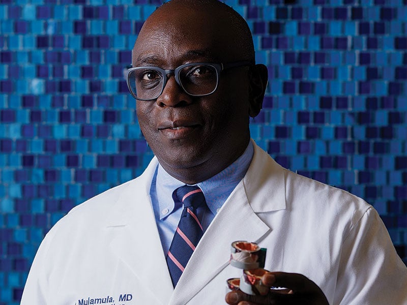 Dr. Alexander Mulamula Uses New Treatment for Lung Cancer