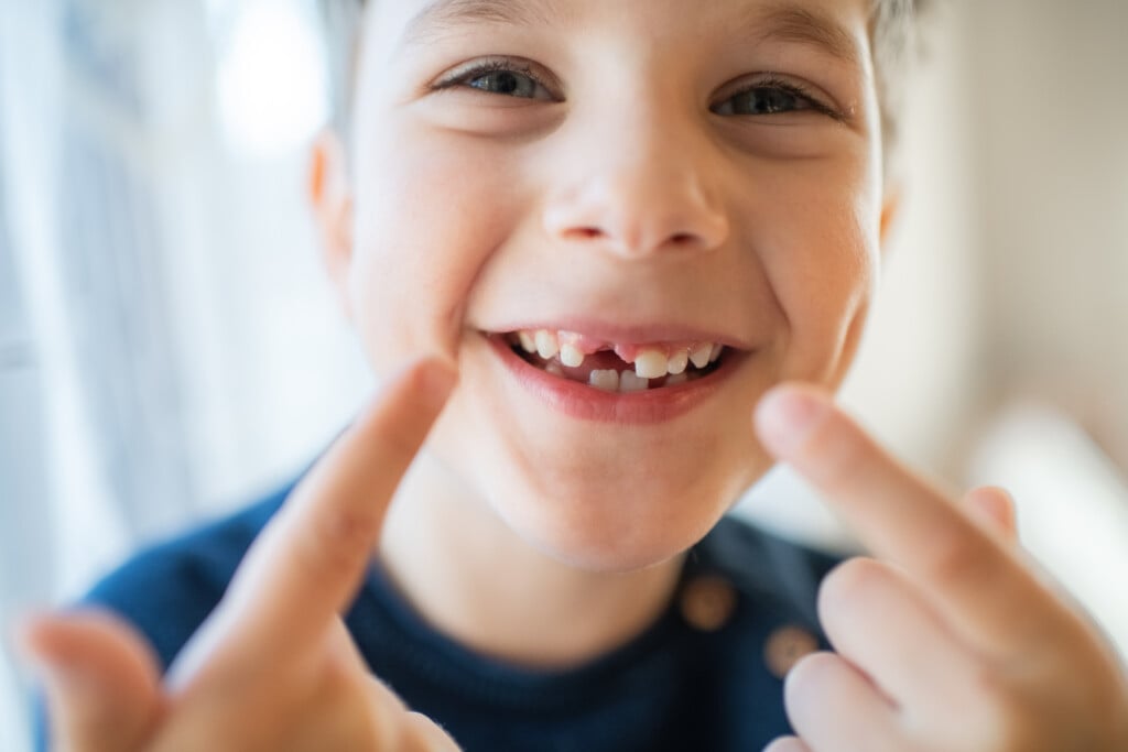 Cute Little Boy Smiling With A Milky Tooth Gap