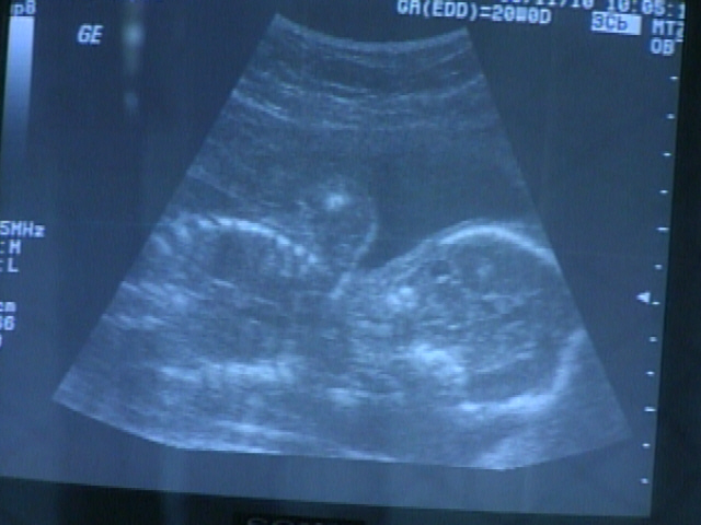 Blog: 21 Week Check Up