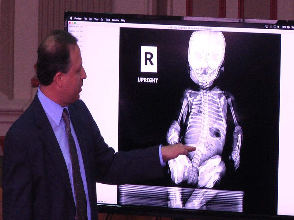 Coroner Gives Testimony On Baby Weaver's Death