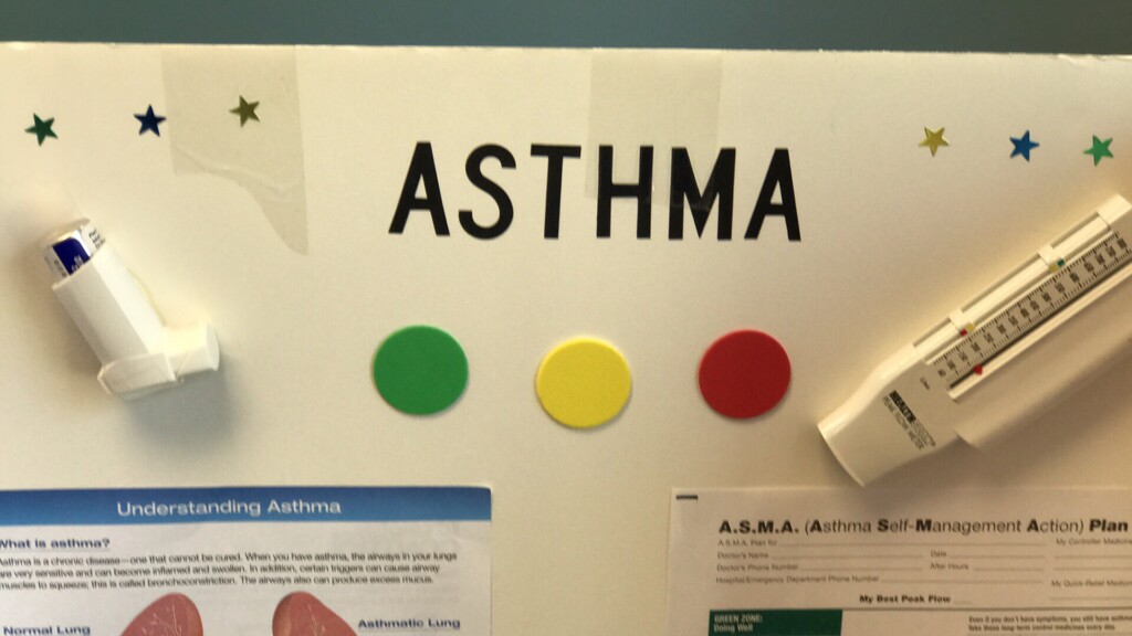 Asthma